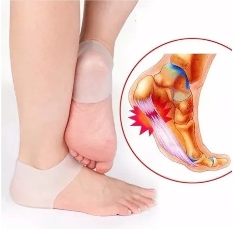 Protetor de Silicone para Calcanhar Feet Care Gwen - 6 Unidades